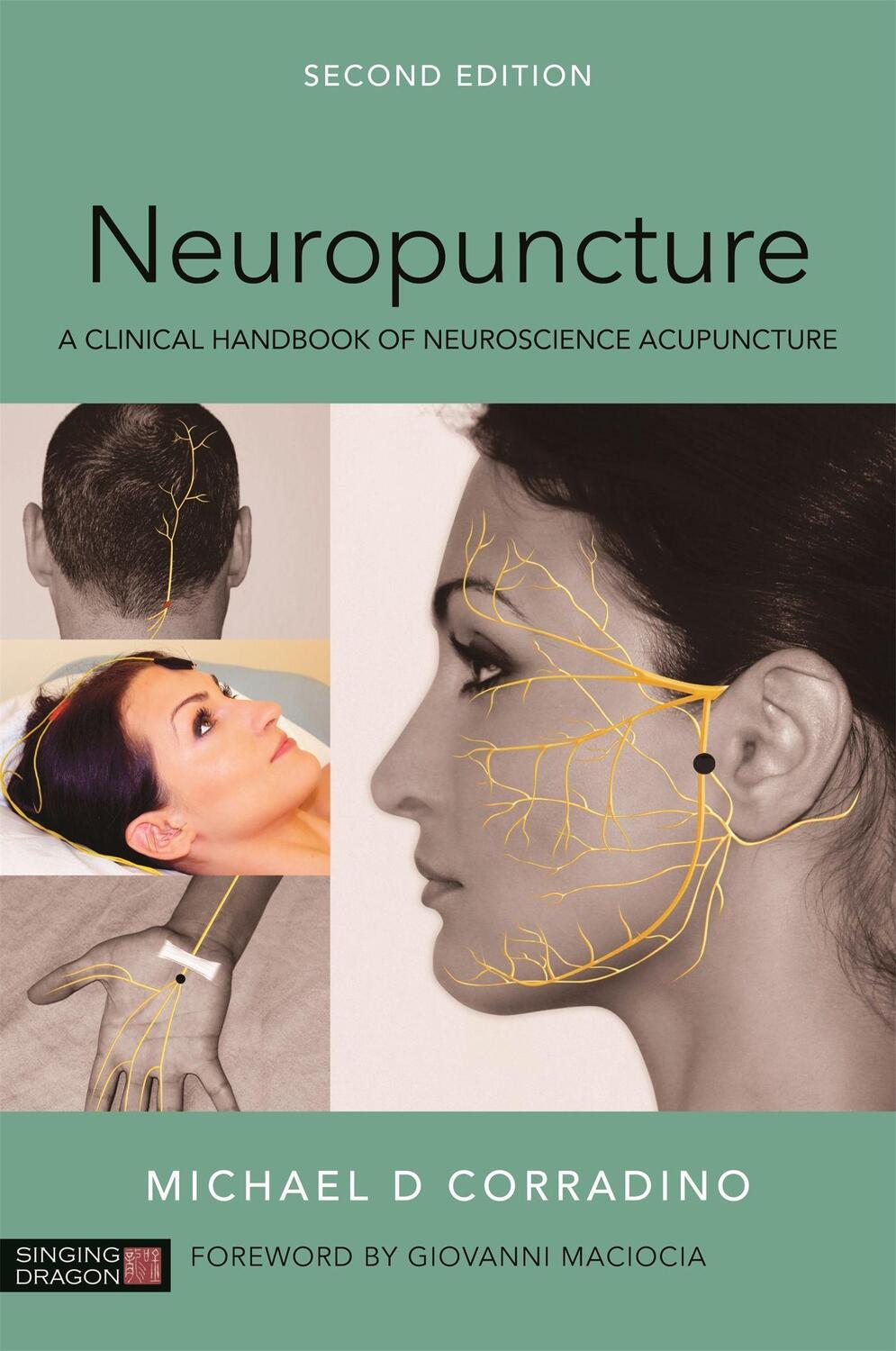 Cover: 9781848193314 | Neuropuncture | A Clinical Handbook of Neuroscience Acupuncture | Buch