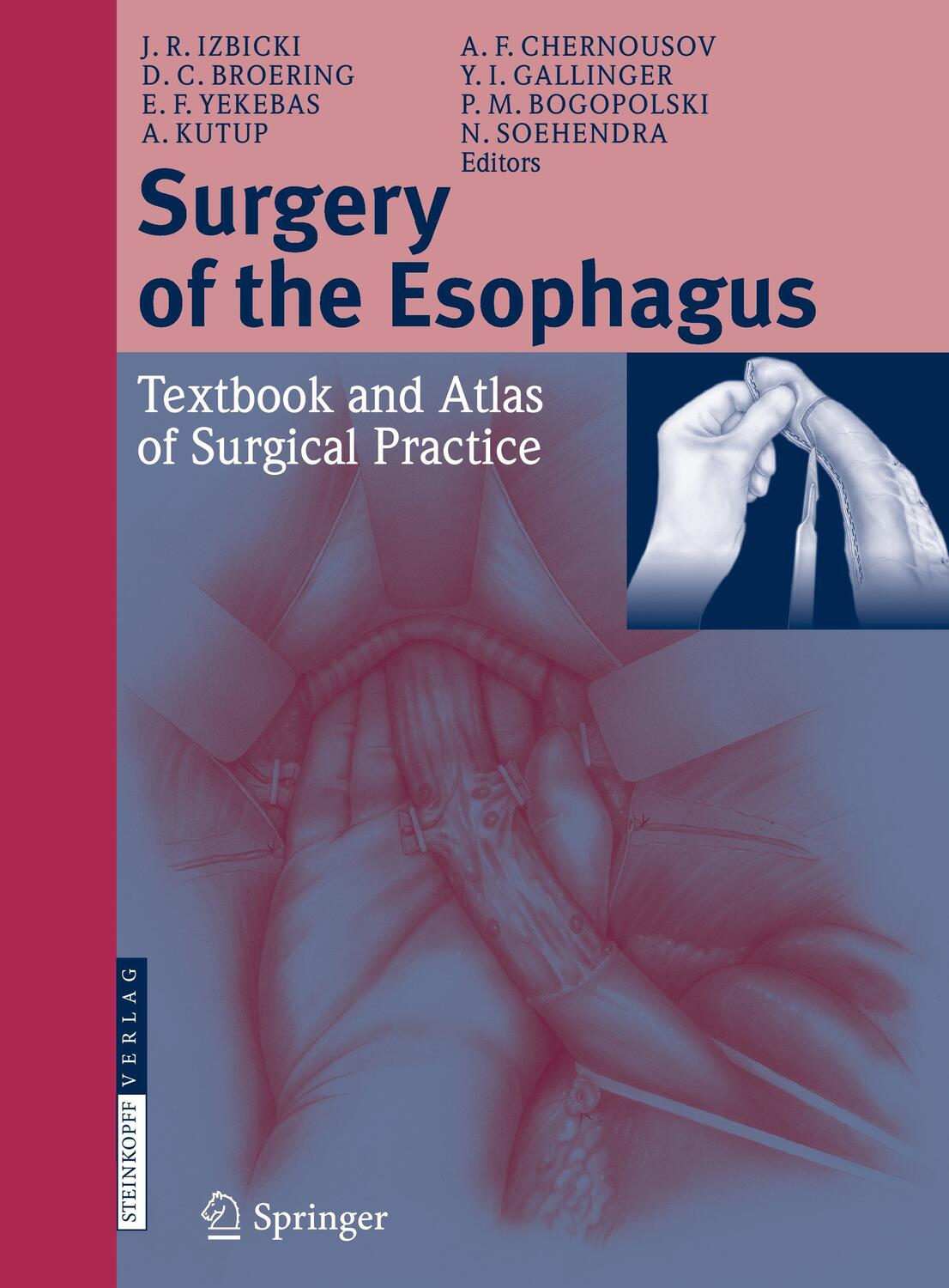 Cover: 9783798513099 | Surgery of the Esophagus | Textbook and Atlas of Surgical Practice