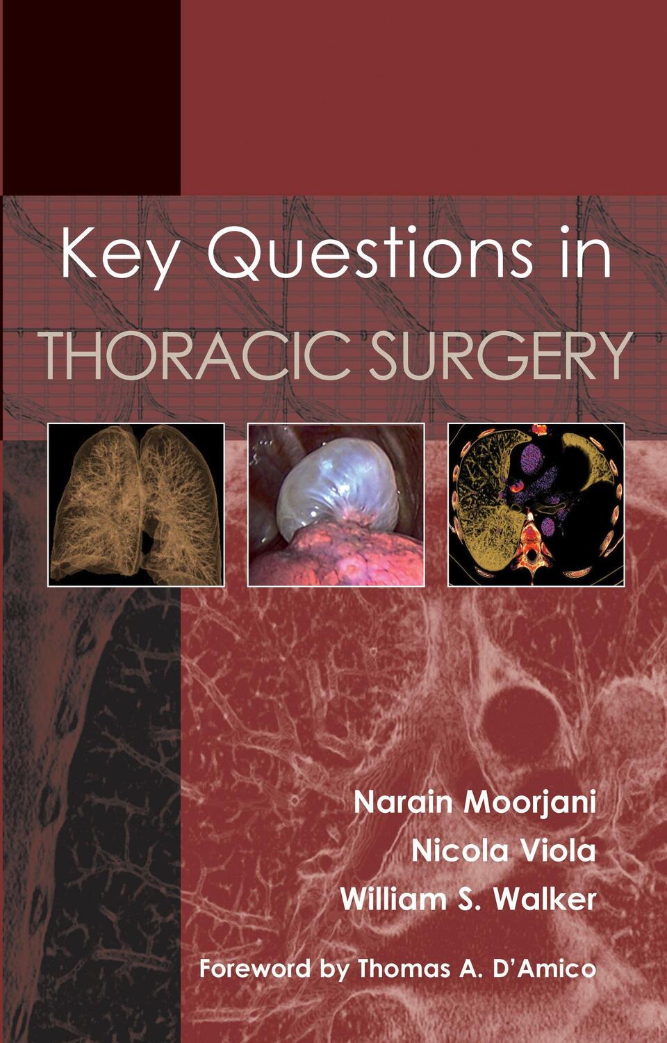 Cover: 9781903378861 | Key Questions in Thoracic Surgery | Narain Moorjani (u. a.) | Buch