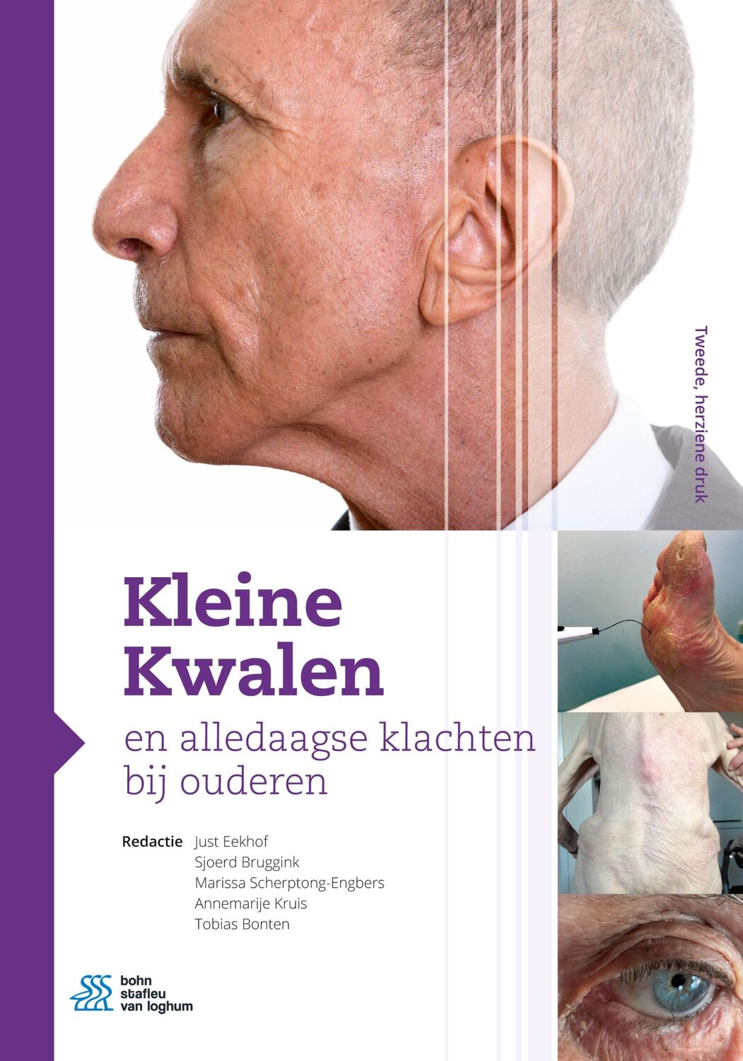 Cover: 9789036825481 | Kleine Kwalen en alledaagse klachten bij ouderen | Just Eekhof (u. a.)