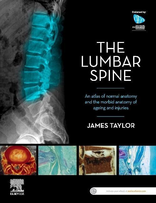 Cover: 9780729543132 | The Lumbar Spine | James Taylor | Taschenbuch | Englisch | 2022