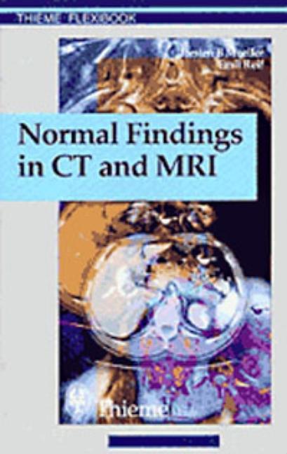 Cover: 9783131165213 | Normal Findings in CT and MRI, A1, print | Torsten Bert Möller (u. a.)