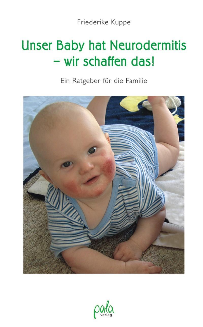 Cover: 9783895662300 | Unser Baby hat Neurodermitis - wir schaffen das! | Friederike Kuppe