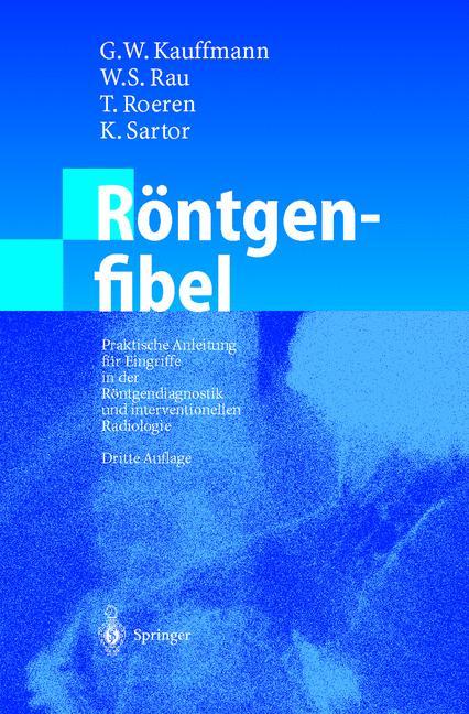 Cover: 9783642624889 | Röntgenfibel | G. W. Kauffmann (u. a.) | Taschenbuch | Paperback | xx