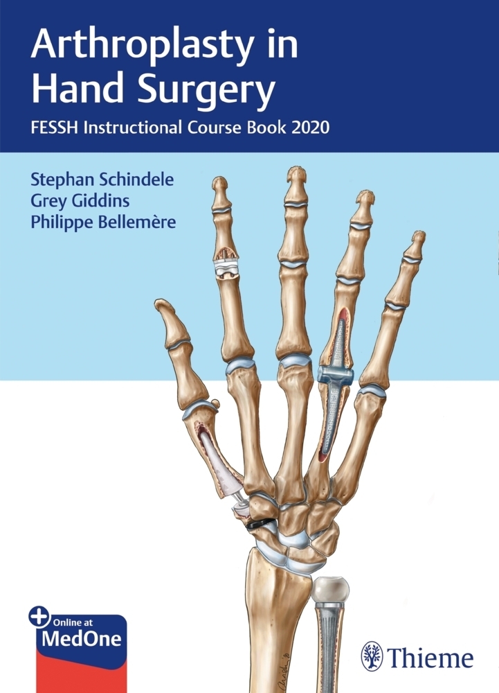 Cover: 9783132431744 | Arthroplasty in Hand Surgery | Stephan Schindele (u. a.) | Bundle