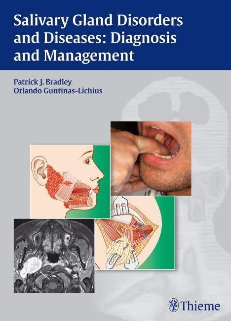 Cover: 9783131464910 | Salivary Gland Disorders and Diseases | Diagnosis and Management