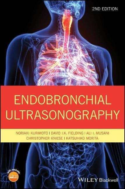 Cover: 9781119233947 | Endobronchial Ultrasonography | Noriaki Kurimoto (u. a.) | Buch | 2020