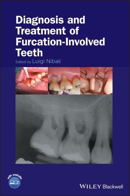 Cover: 9781119270652 | Diagnosis and Treatment of Furcation-Involved Teeth | Luigi Nibali