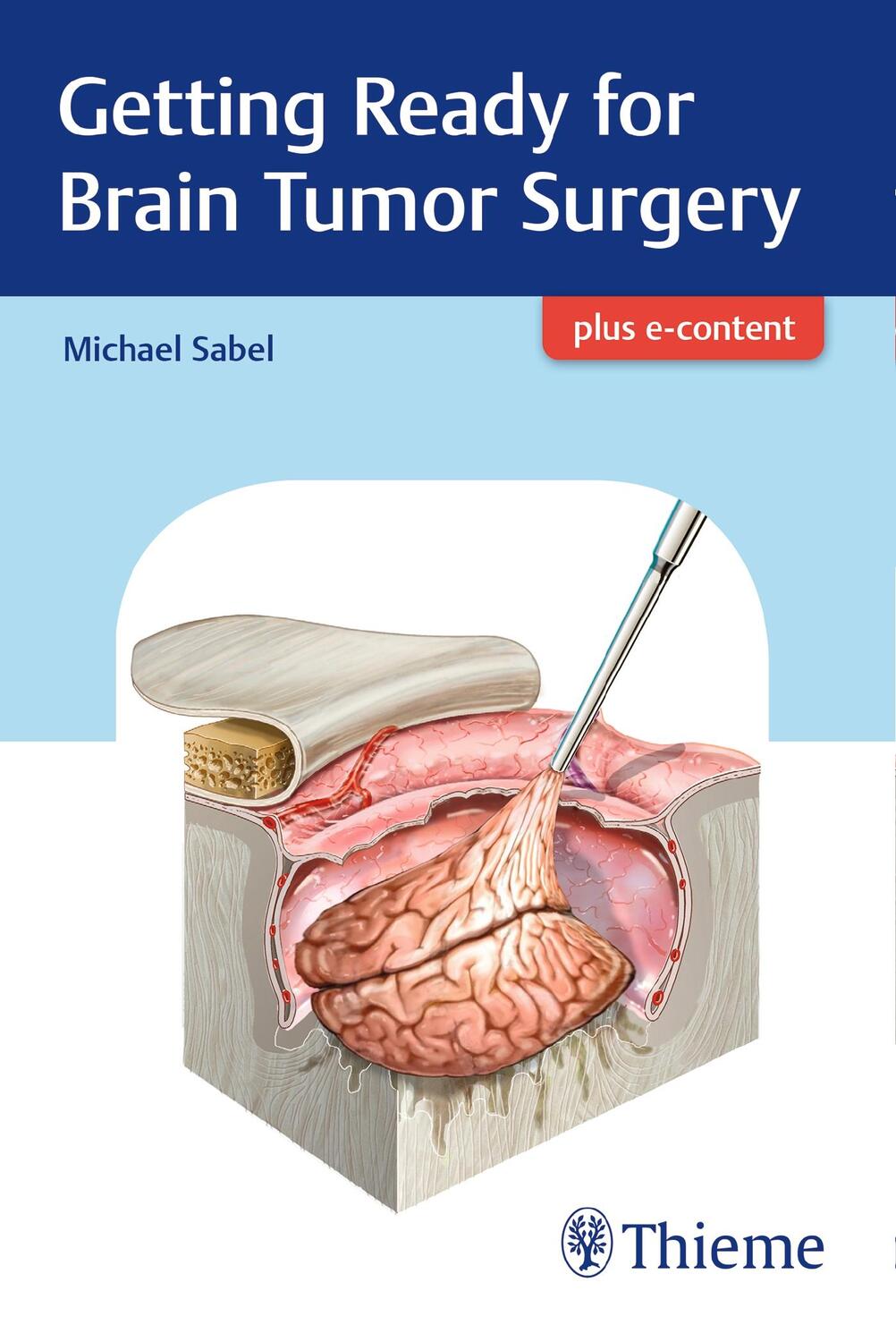 Cover: 9783132409576 | Getting Ready for Brain Tumor Surgery | Michael Sabel | Taschenbuch