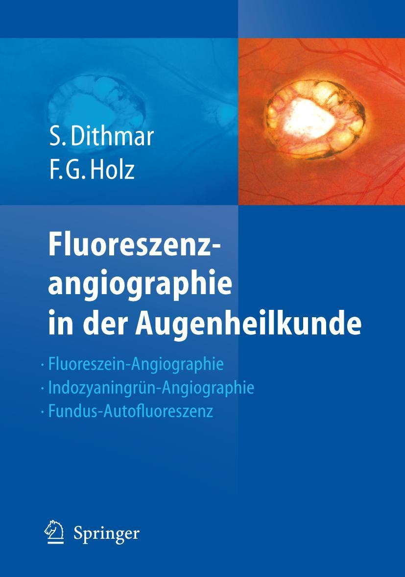 Cover: 9783540352235 | Fluoreszenzangiographie in der Augenheilkunde | Frank G. Holz (u. a.)