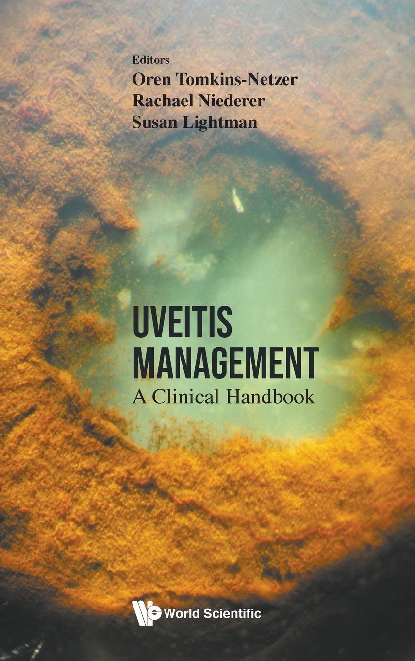 Cover: 9789811251467 | Uveitis Management | A Clinical Handbook | Oren Tomkins-Netzer | Buch