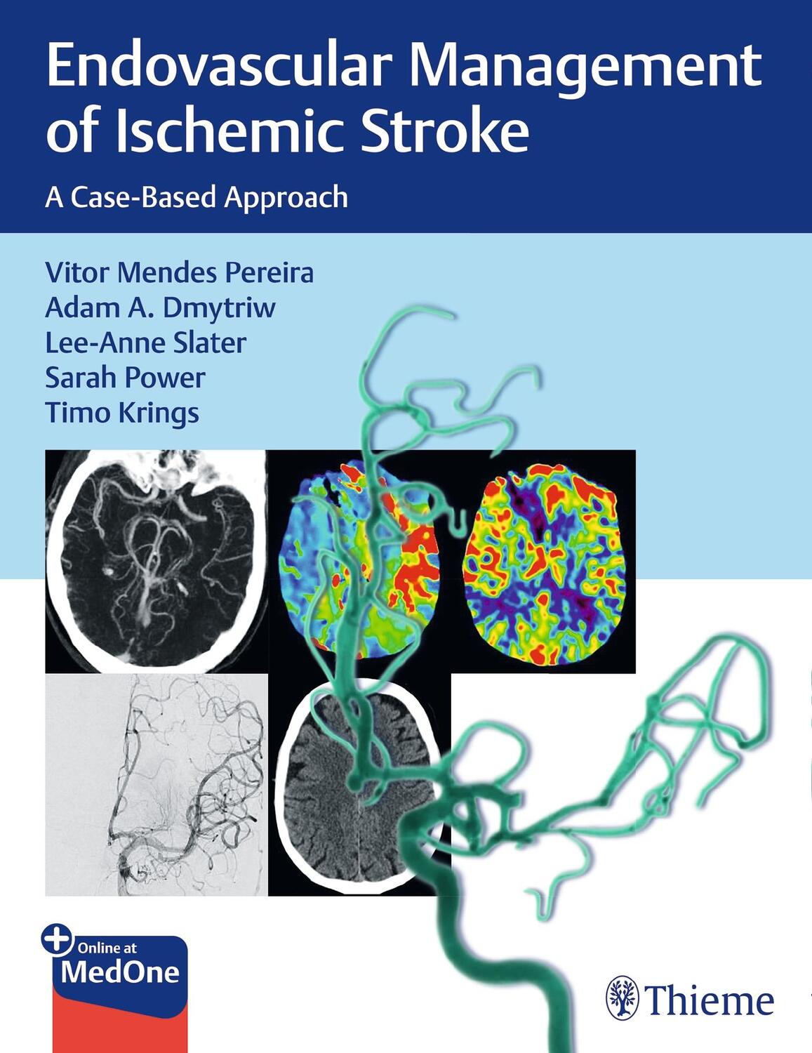 Cover: 9781626232754 | Endovascular Management of Ischemic Stroke | A Case-Based Approach