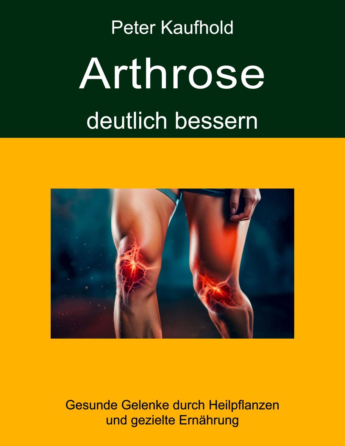 Cover: 9783759733085 | Arthrose deutlich bessern | Peter Kaufhold | Taschenbuch | Paperback