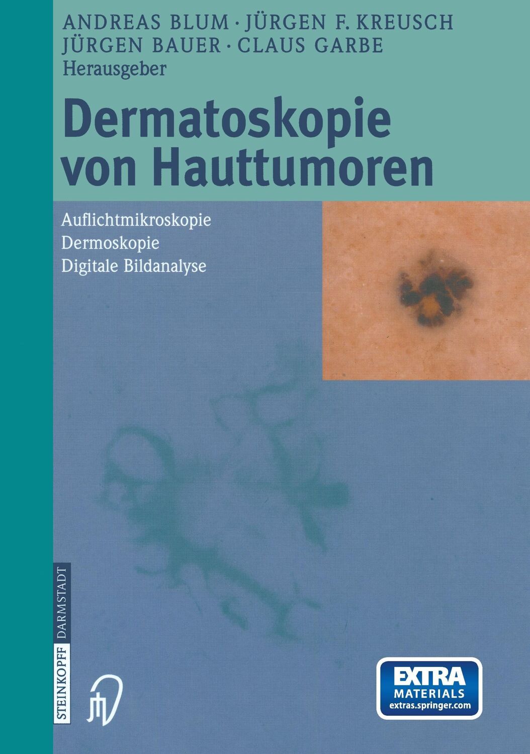 Cover: 9783642632686 | Dermatoskopie von Hauttumoren | A. Blum (u. a.) | Taschenbuch | xvi