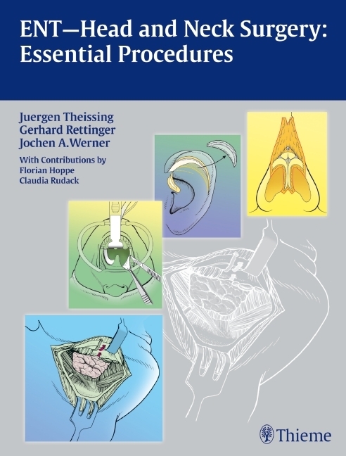 Cover: 9783131486219 | ENT-Head and Neck Surgery: Essential Procedures | Theissing (u. a.)