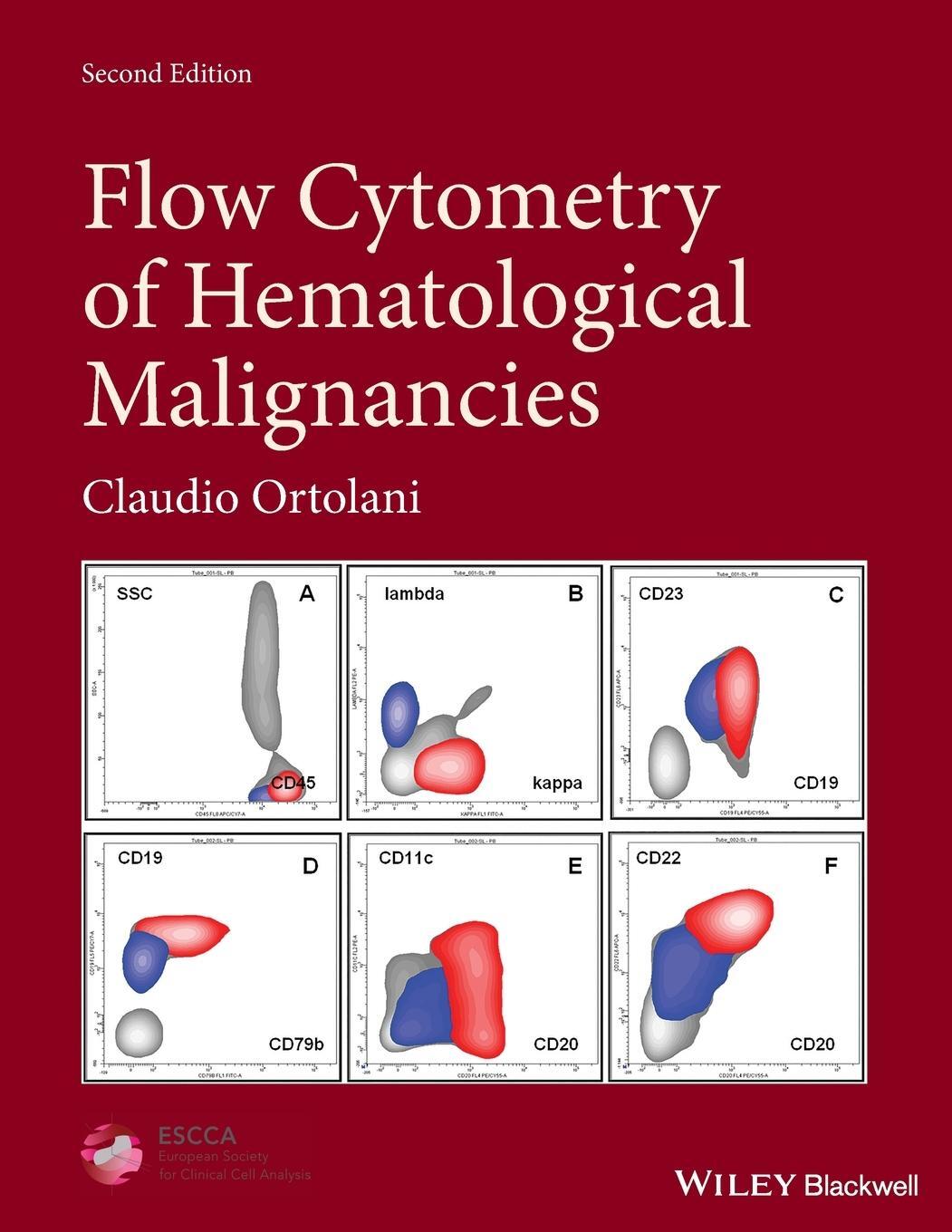 Cover: 9781119611257 | Flow Cytometry of Hematological Malignancies | Claudio Ortolani | Buch