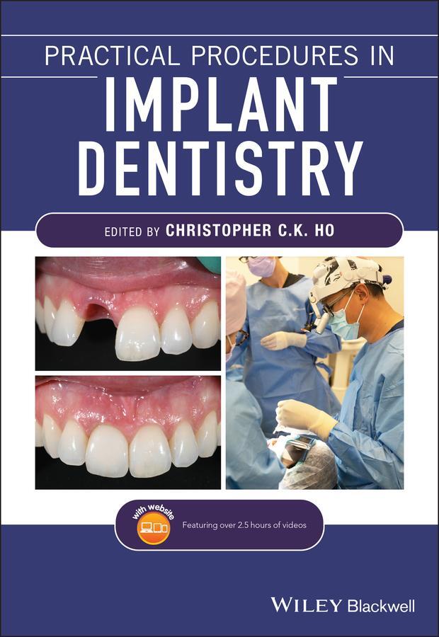 Cover: 9781119399179 | Practical Procedures in Implant Dentistry | Christopher C K Ho | Buch