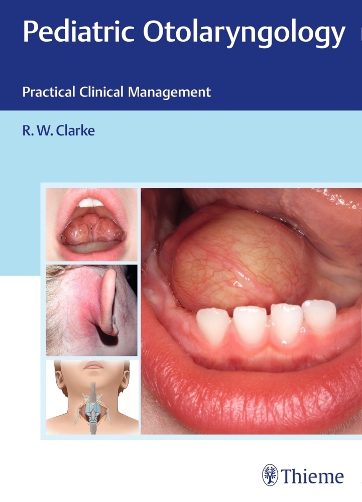 Cover: 9783131699015 | Pediatric Otolaryngology | Practical Clinical Management | Clarke