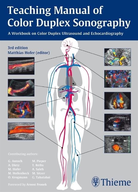 Cover: 9783131275936 | Teaching Manual of Color Duplex Sonography | Matthias Hofer | Buch