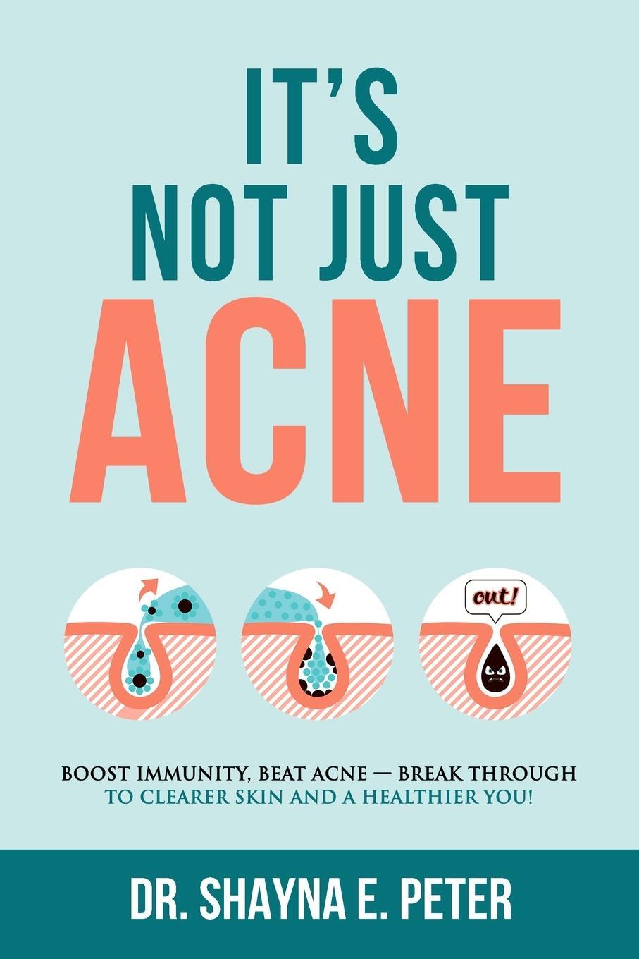 Cover: 9781735465708 | It's Not Just Acne | Shayna E Peter | Taschenbuch | Paperback | 2020