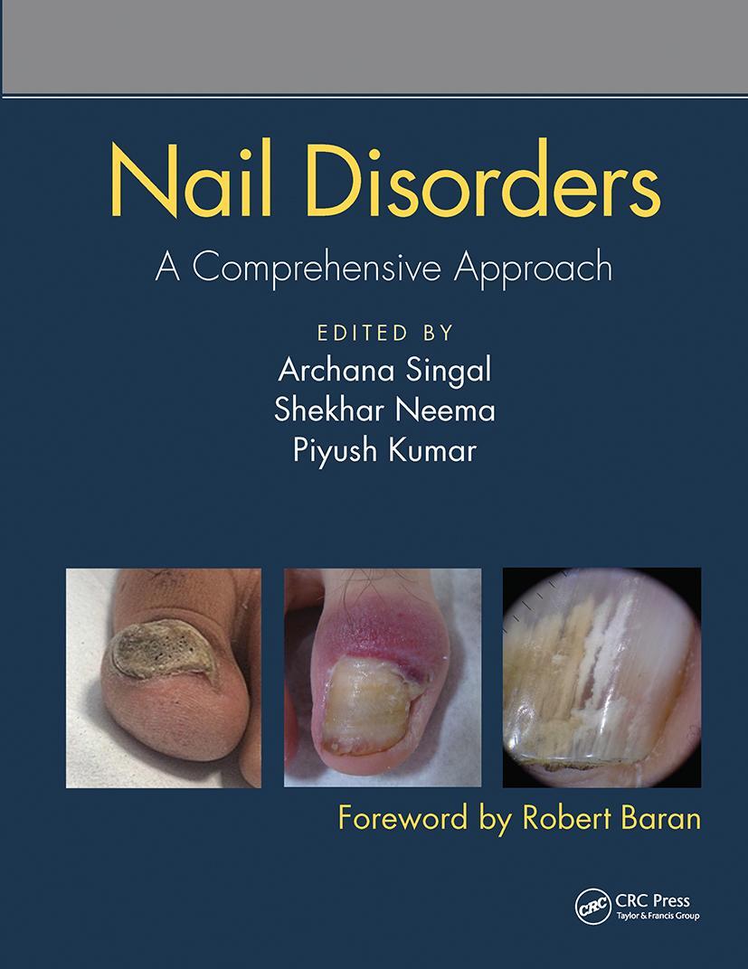 Cover: 9780367731717 | Nail Disorders | A Comprehensive Approach | Taschenbuch | Englisch