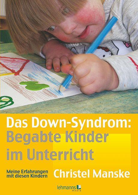 Cover: 9783865414434 | Das Down-Sydrom - Begabte Kinder im Unterricht | Christel Manske