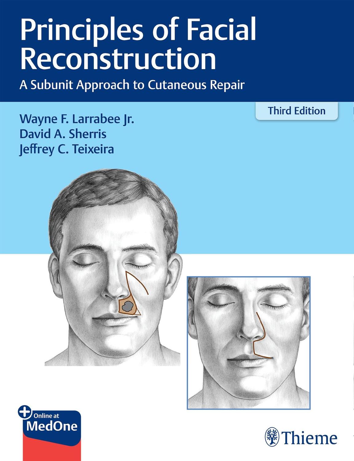 Cover: 9781684201068 | Principles of Facial Reconstruction | Wayne F. Larrabee (u. a.) | 2021