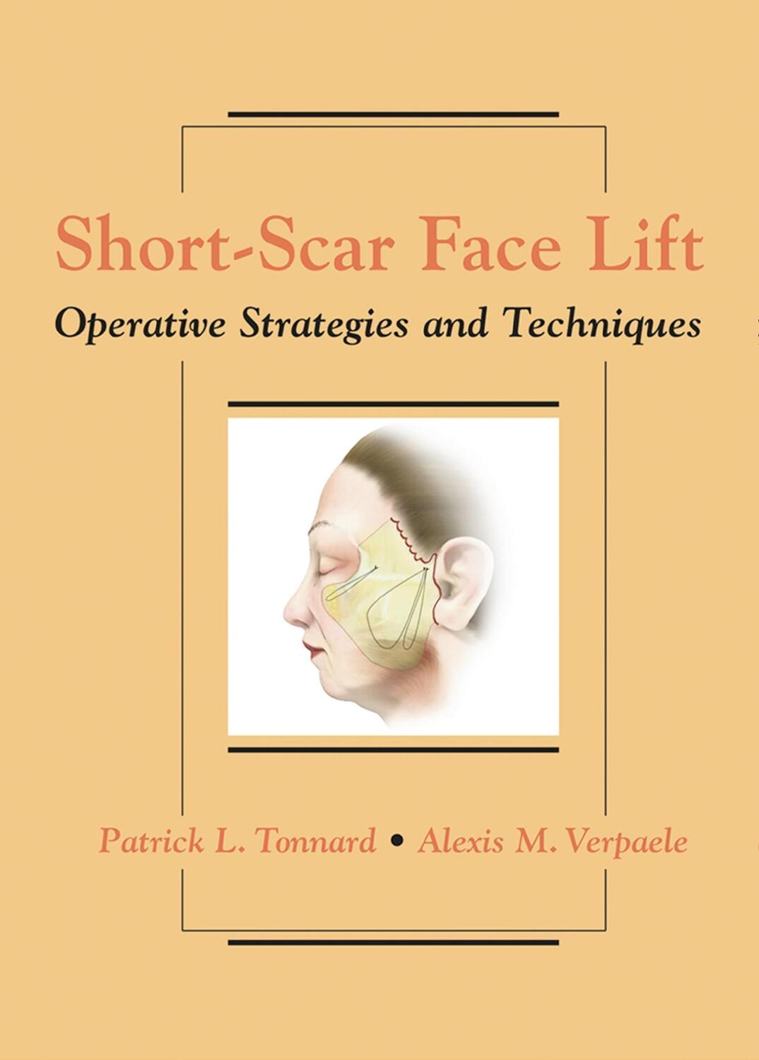 Cover: 9781626236325 | Short-Scar Face Lift | Operative Strategies and Techniques | Buch