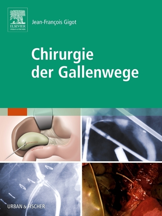 Cover: 9783437313066 | Chirurgie der Gallenwege | Jean-François Gigot | Taschenbuch | XVI