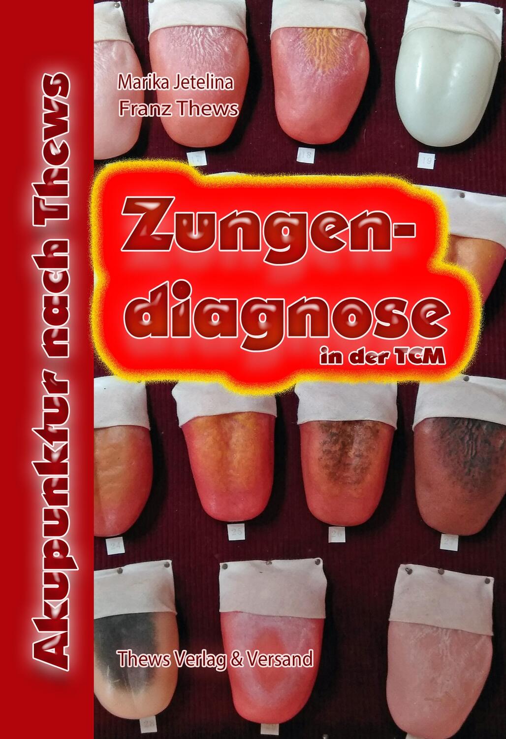 Cover: 9783936456141 | Zungendiagnose in 54 Bildern | Traditionelle Chinesische Medizin