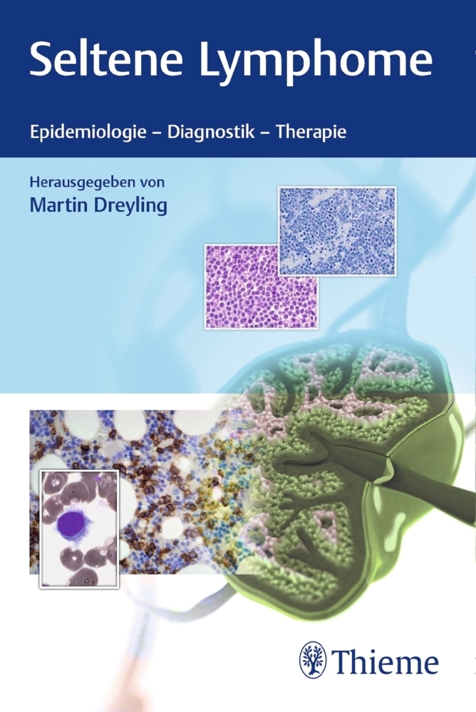 Cover: 9783132400504 | Seltene Lymphome | Epidemiologie, Diagnostik, Therapie | Dreyling
