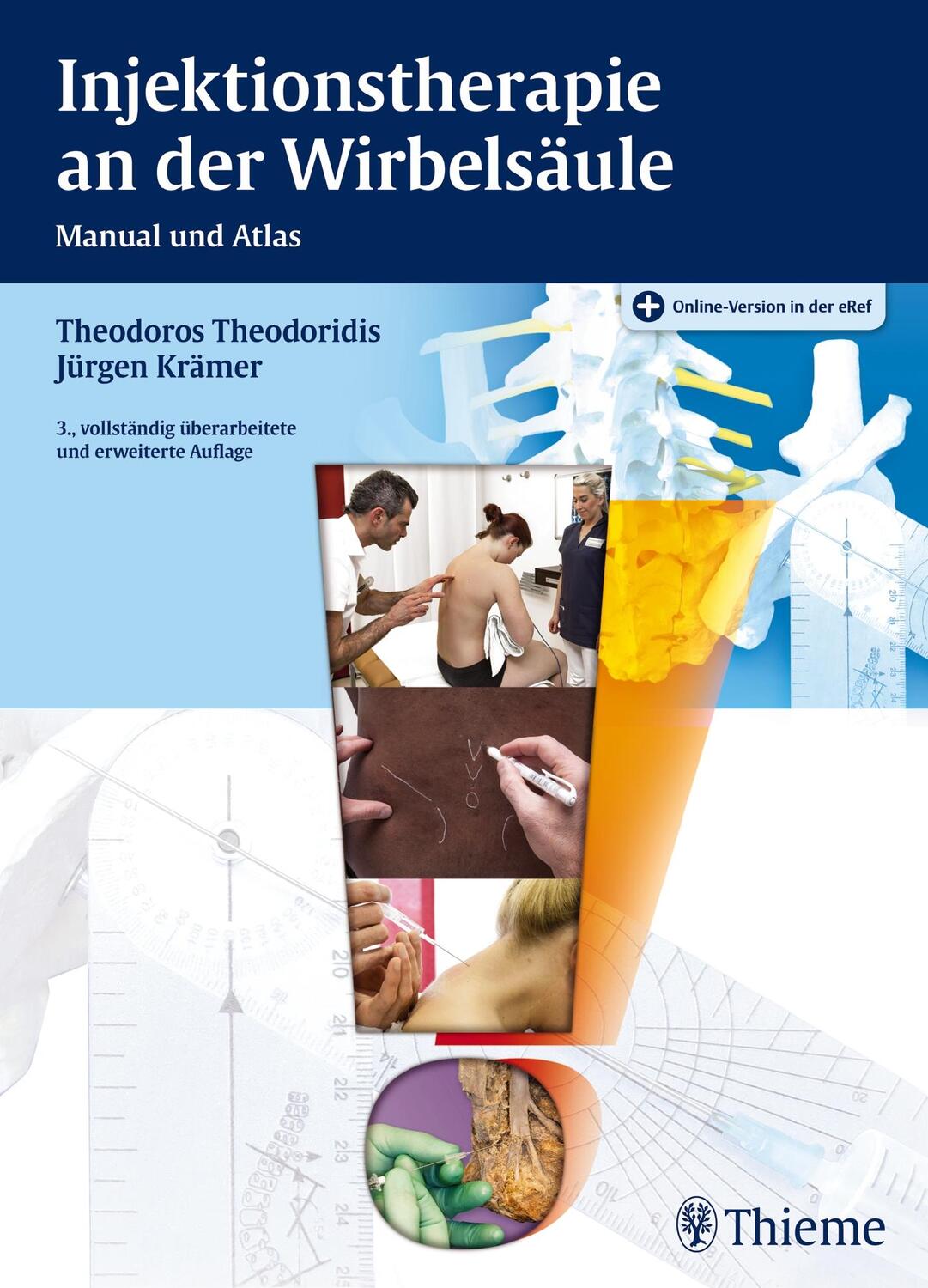 Cover: 9783131410436 | Injektionstherapie an der Wirbelsäule | Manual und Atlas | Krämer