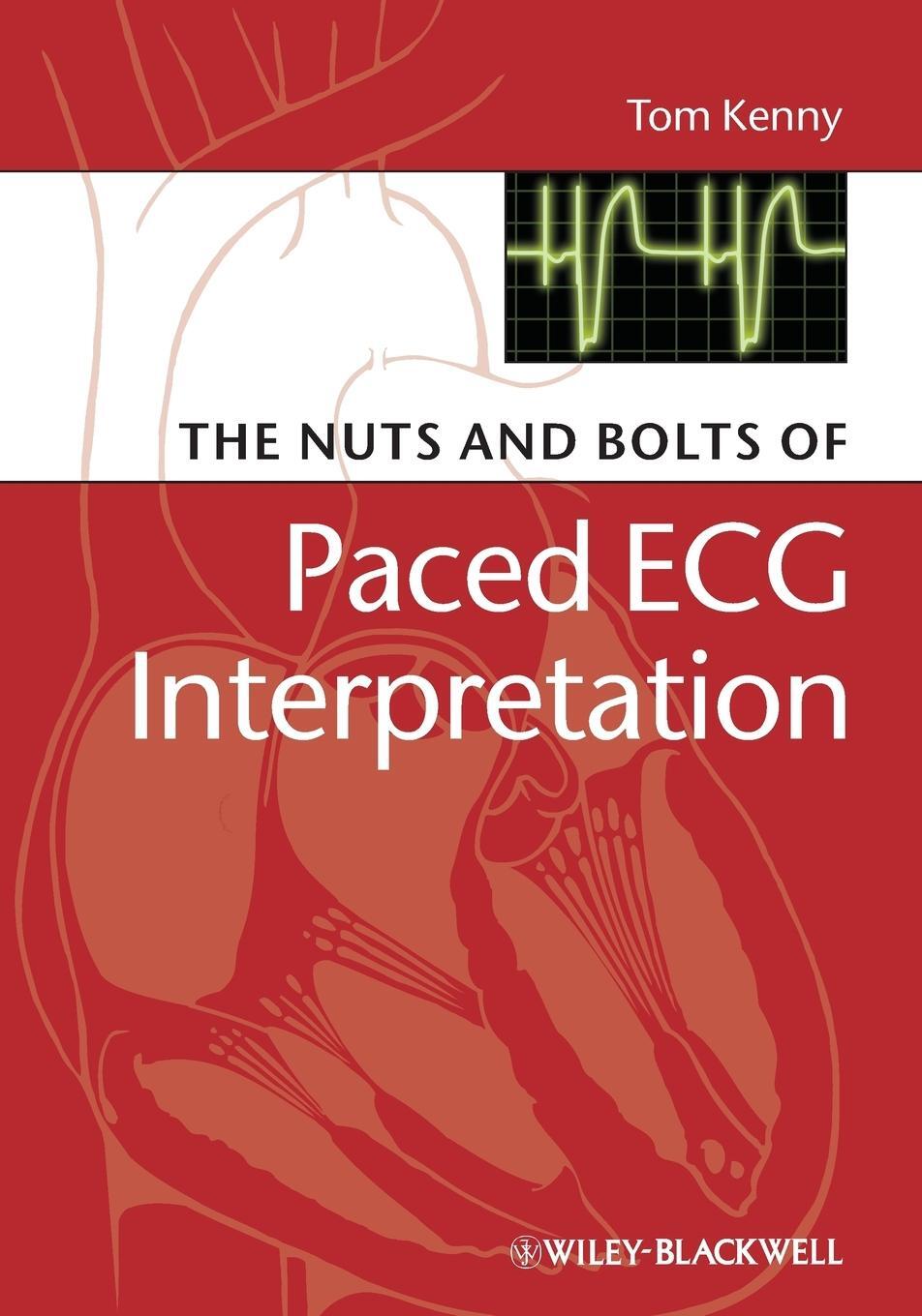 Cover: 9781405184045 | The Nuts and Bolts of Paced ECG Interpretation | Tom Kenny | Buch