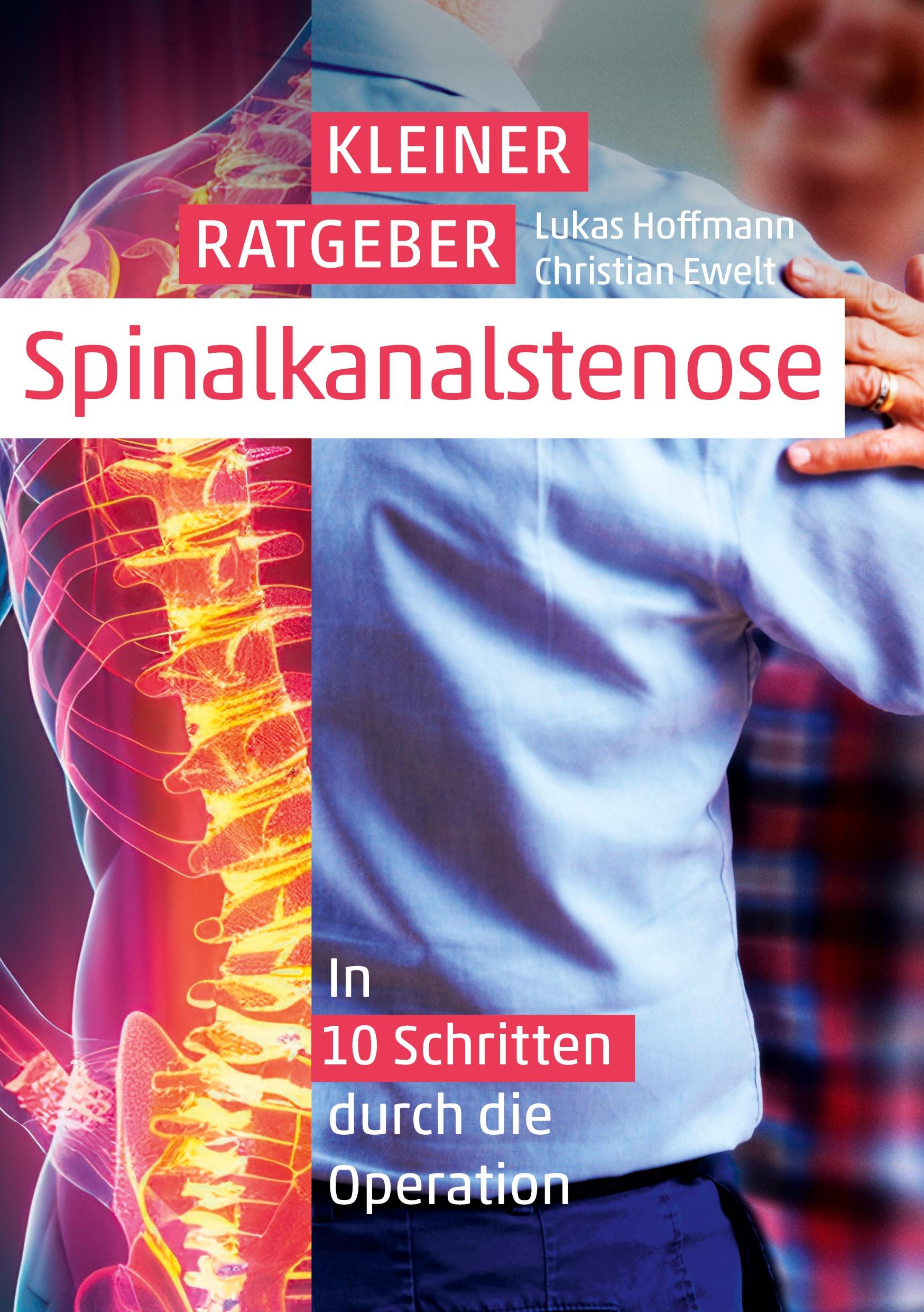 Cover: 9783759272461 | Kleiner Ratgeber Spinalkanalstenose | Lukas Hoffmann | Taschenbuch