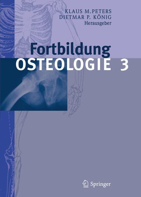 Cover: 9783642053849 | Fortbildung Osteologie. Bd.3 | Klaus M. Peters (u. a.) | Taschenbuch