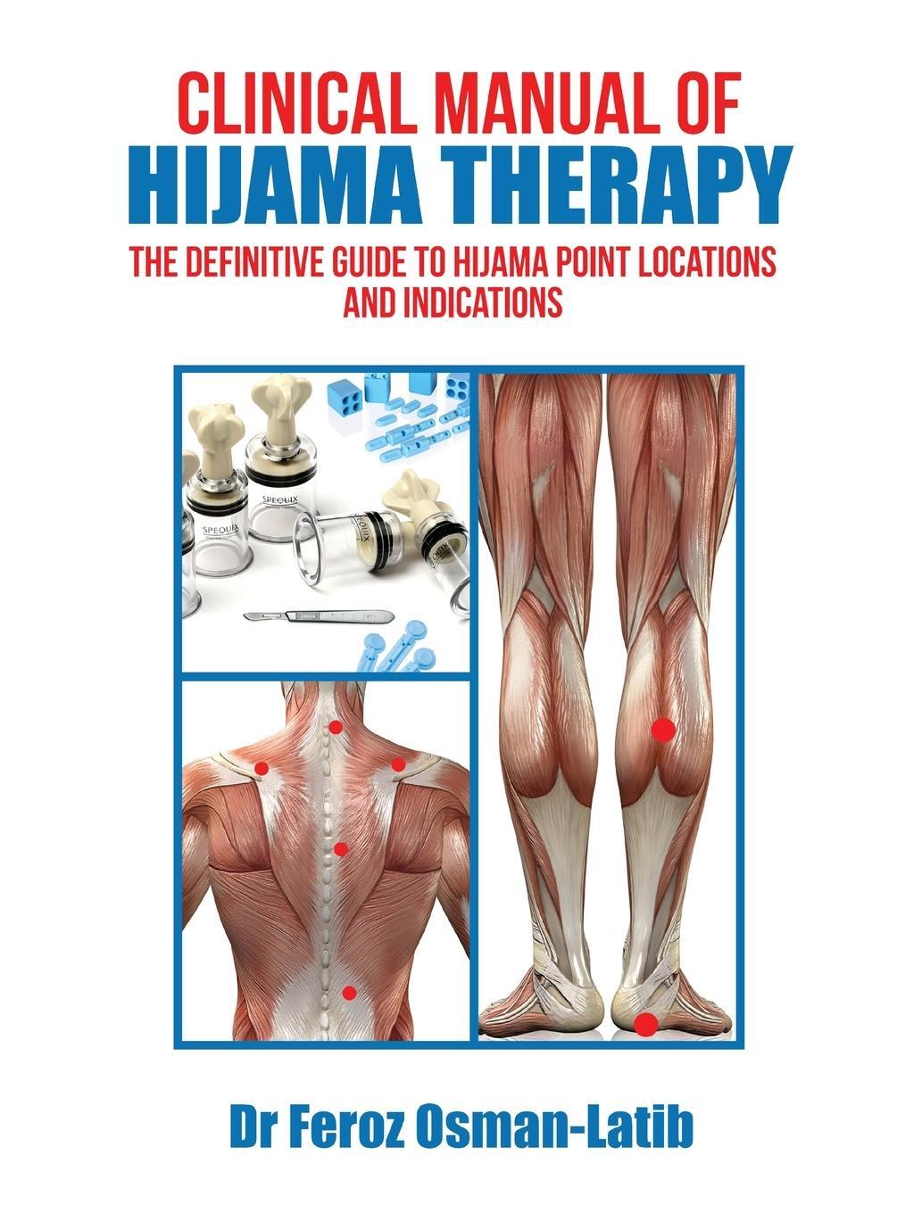 Cover: 9780991145560 | Clinical Manual of Hijama Therapy | Feroz Osman-Latib | Buch | 2019