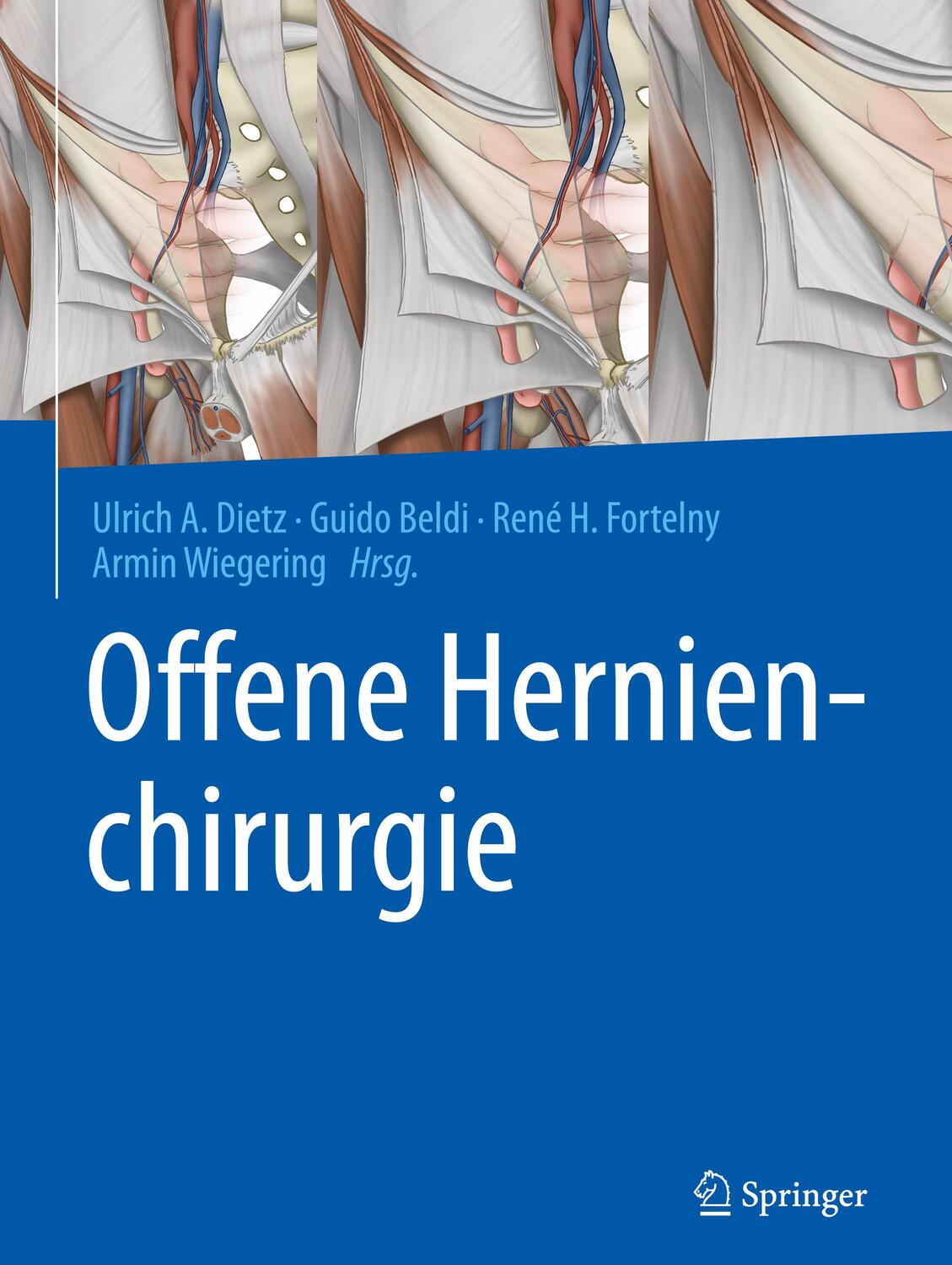 Cover: 9783662613474 | Offene Hernienchirurgie | Ulrich A. Dietz (u. a.) | Buch | Deutsch