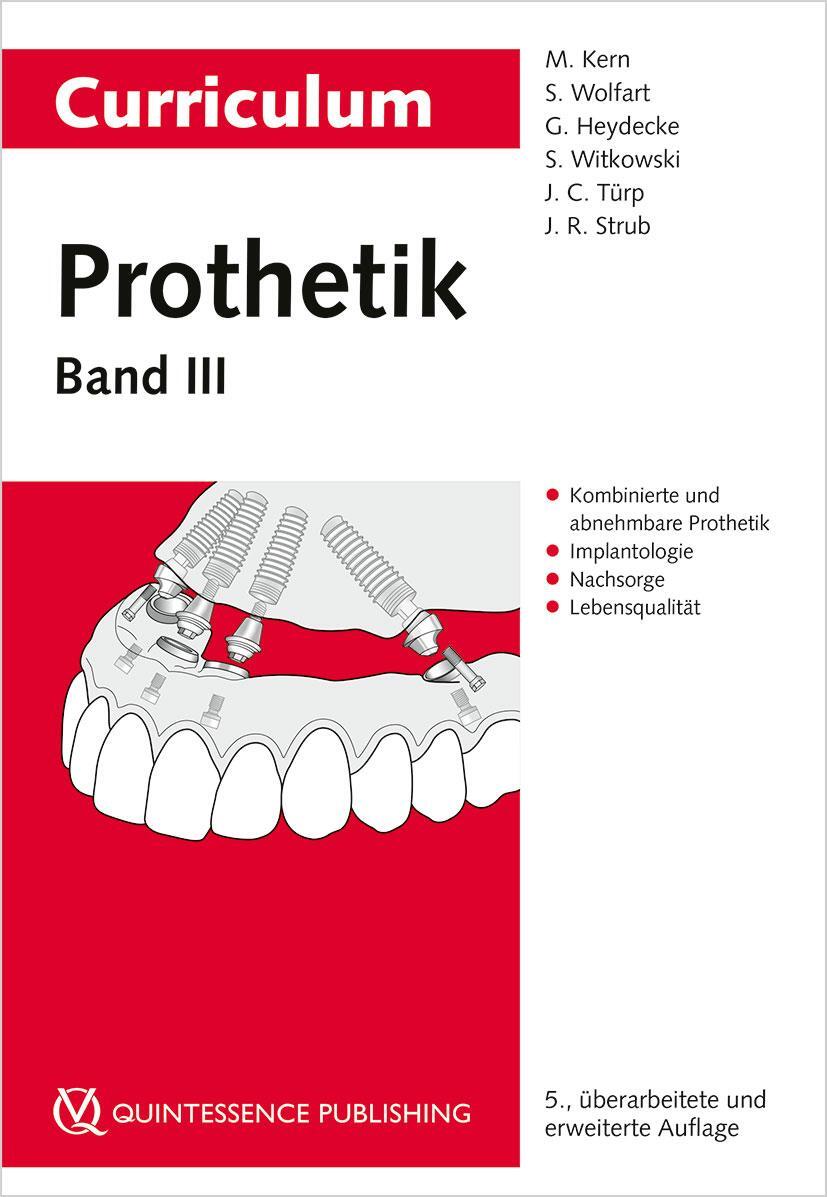 Cover: 9783868675757 | Curriculum Prothetik Band 3 | Matthias Kern (u. a.) | Taschenbuch