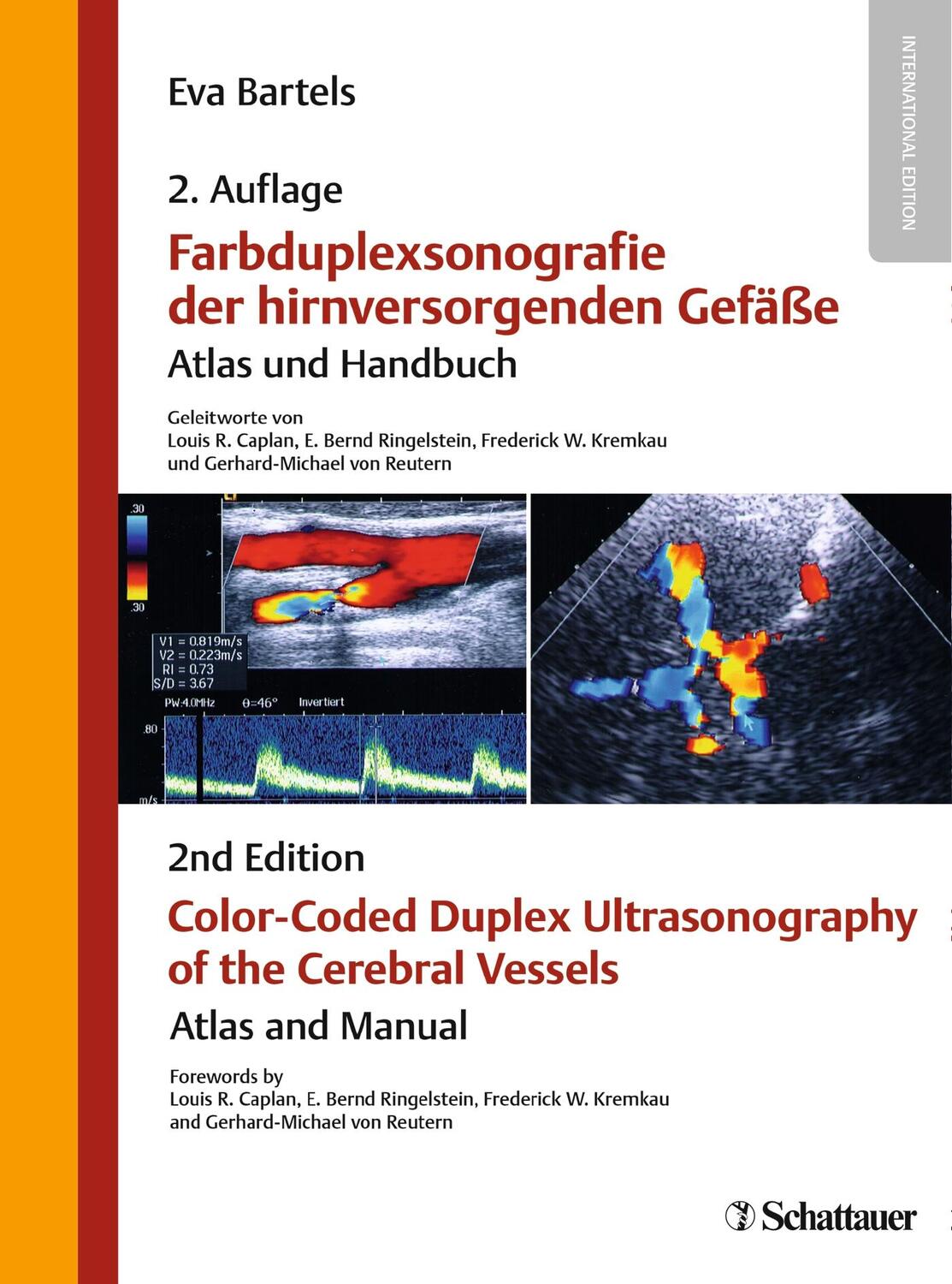 Cover: 9783794530939 | Farbduplexsonografie der hirnversorgenden Gefäße / Color-Coded...