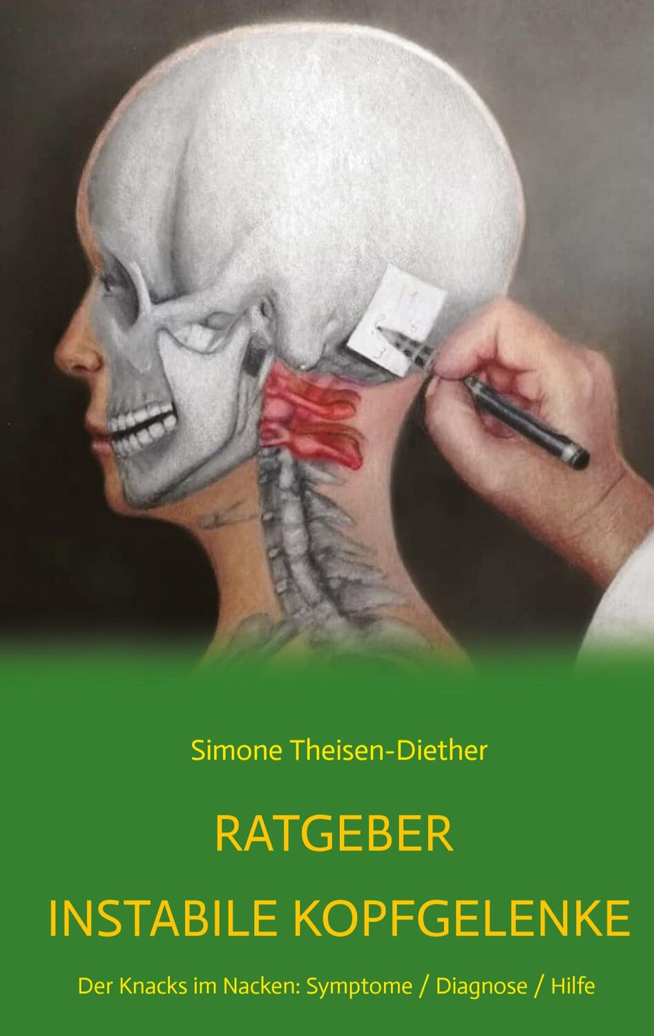 Cover: 9783347704404 | Ratgeber Instabile Kopfgelenke | Simone Theisen-Diether | Buch | 2022