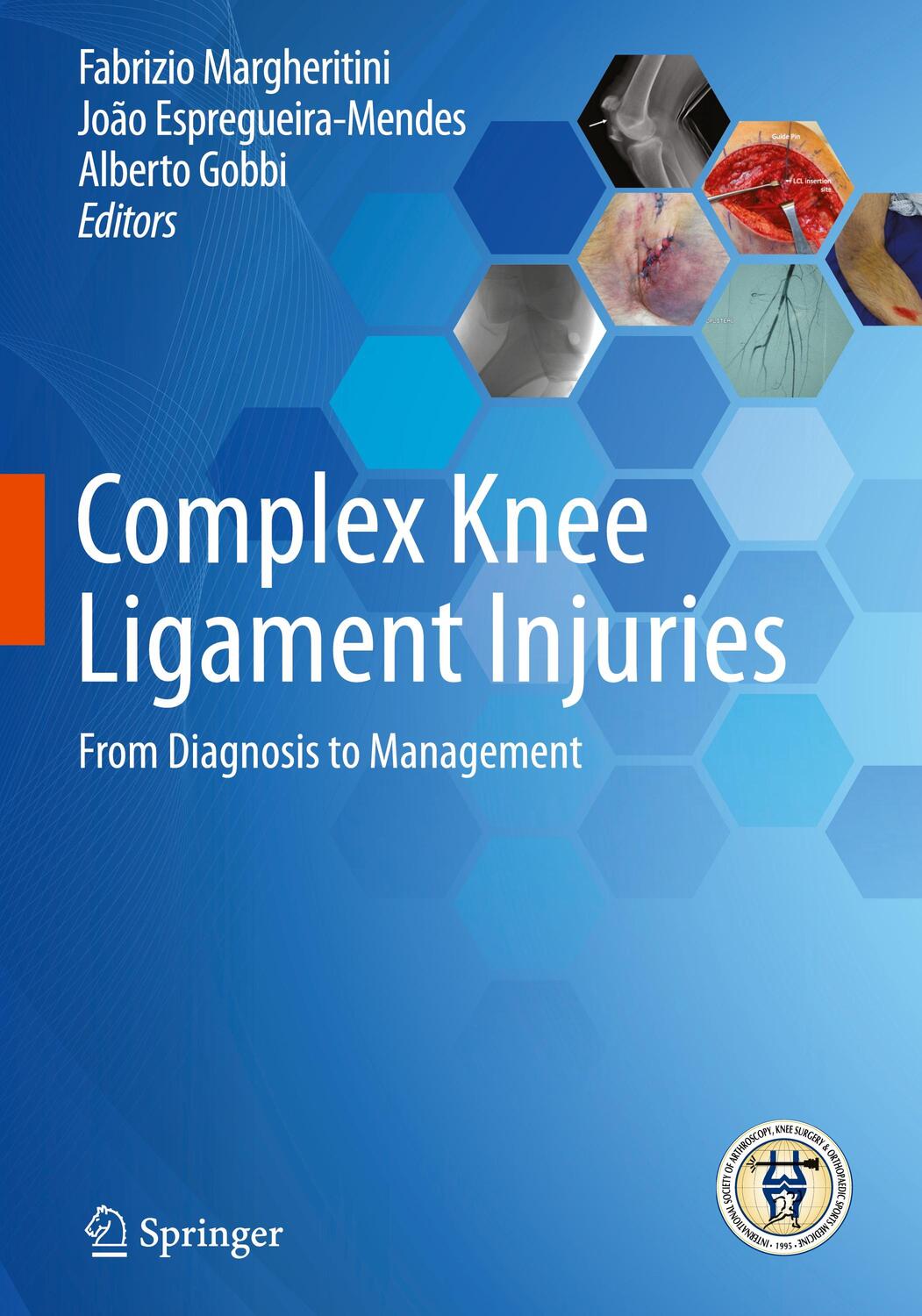 Cover: 9783662582442 | Complex Knee Ligament Injuries | From Diagnosis to Management | Buch