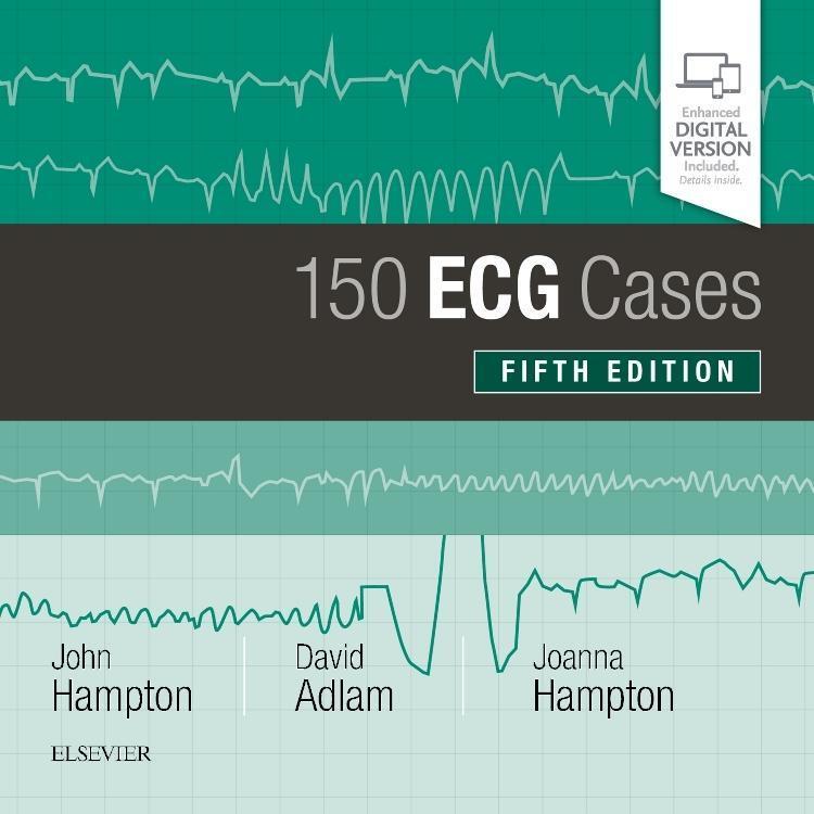 Cover: 9780702074585 | 150 ECG Cases | John Hampton (u. a.) | Taschenbuch | Englisch | 2019