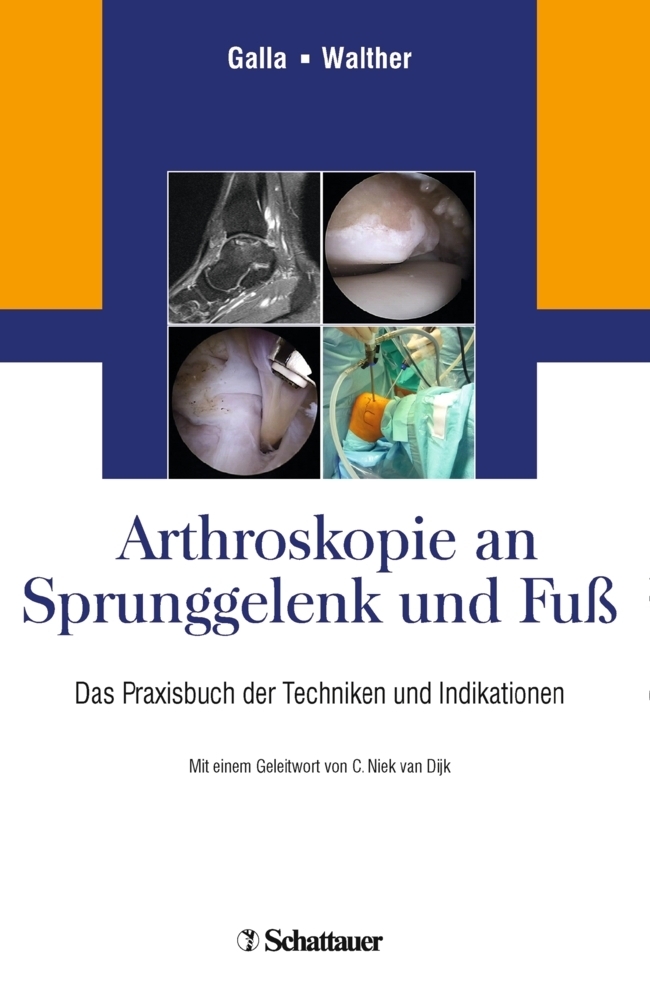Cover: 9783794529674 | Arthroskopie an Sprunggelenk und Fuß | Mellany Galla (u. a.) | Buch