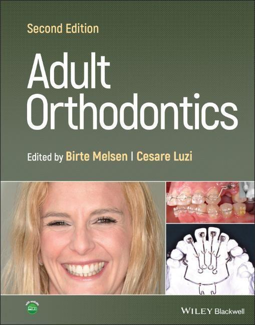 Cover: 9781119775775 | Adult Orthodontics | B Melsen | Buch | 480 S. | Englisch | 2022