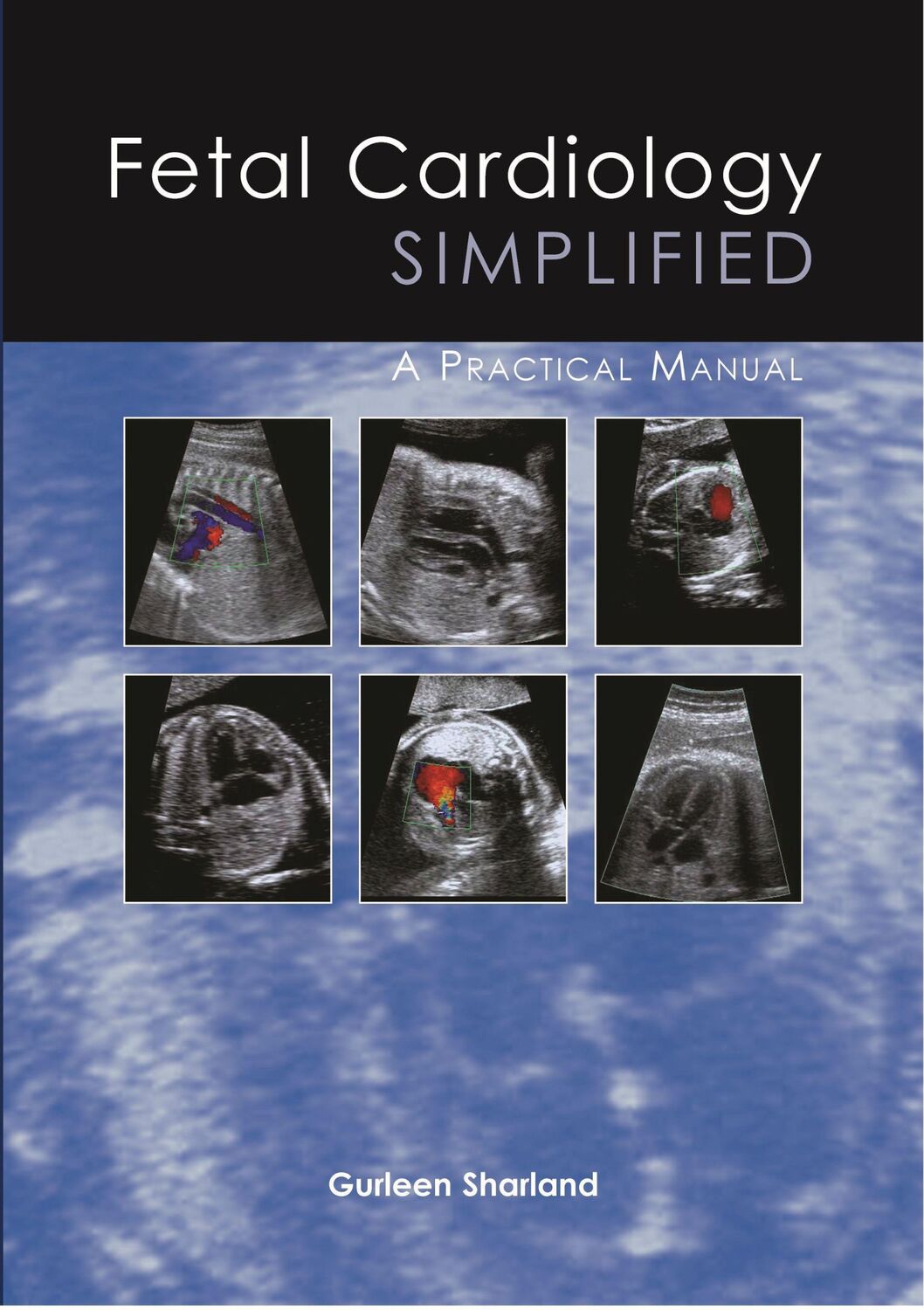 Cover: 9781903378557 | Fetal Cardiology Simplified | A Practical Manual | Gurleen Sharland