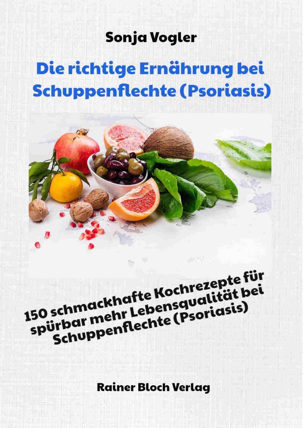 Cover: 9783942179560 | Die richtige Ernährung bei Schuppenflechte (Psoriasis) | Sonja Vogler