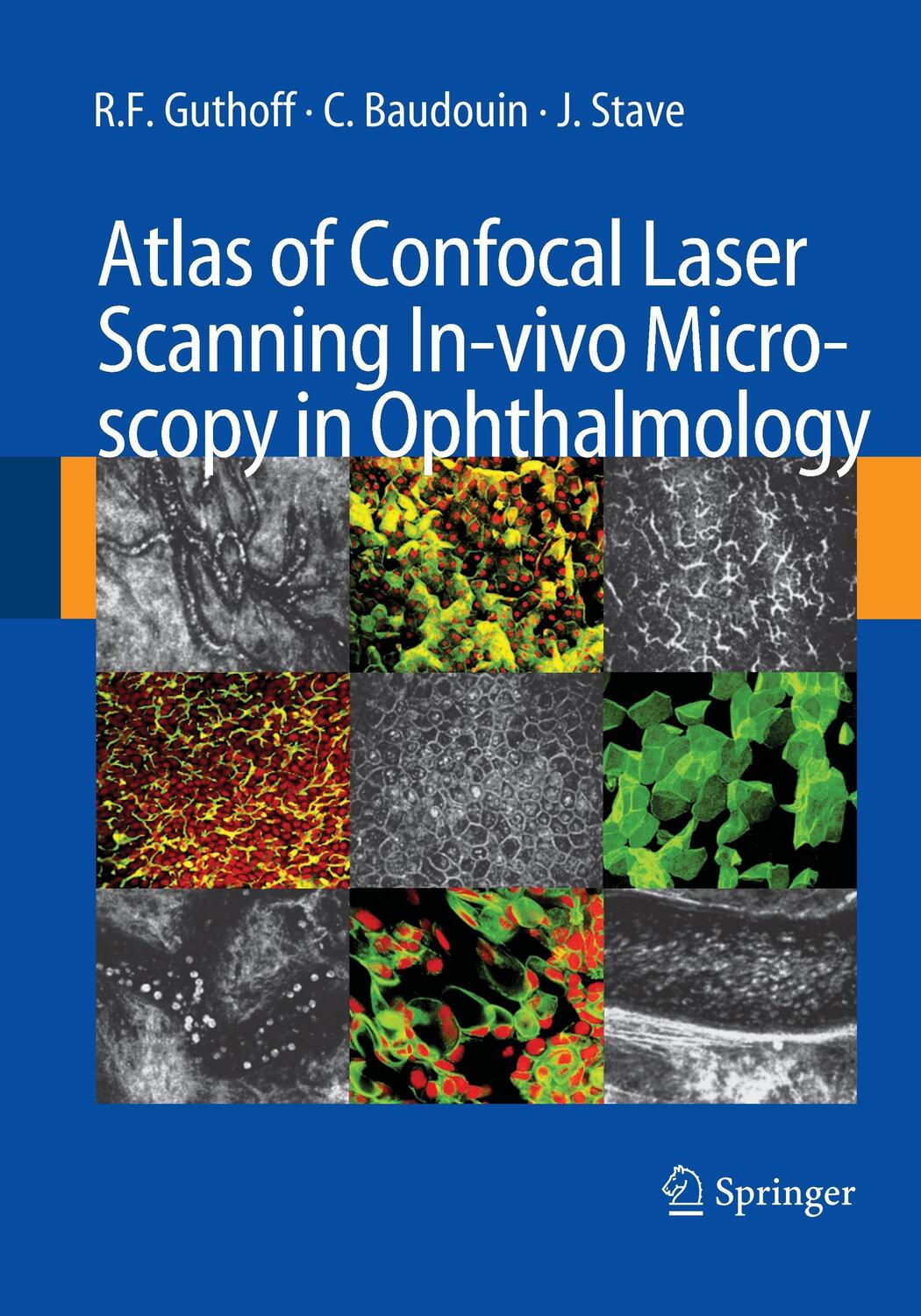Cover: 9783662500613 | Atlas of Confocal Laser Scanning In-vivo Microscopy in Ophthalmology