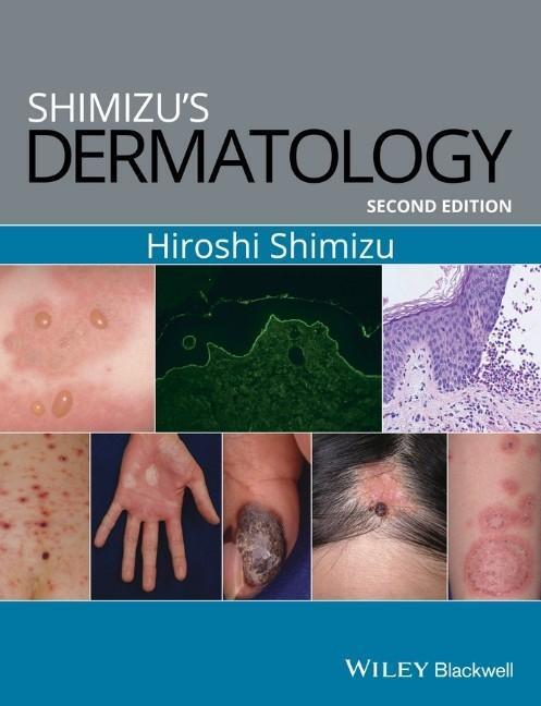 Cover: 9781119099055 | Shimizu's Dermatology | Hiroshi Shimizu | Taschenbuch | 664 S. | 2017