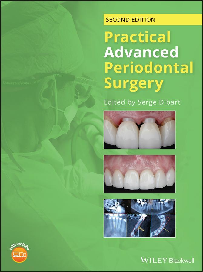 Cover: 9781119196310 | Practical Advanced Periodontal Surgery | Serge Dibart | Buch | 256 S.