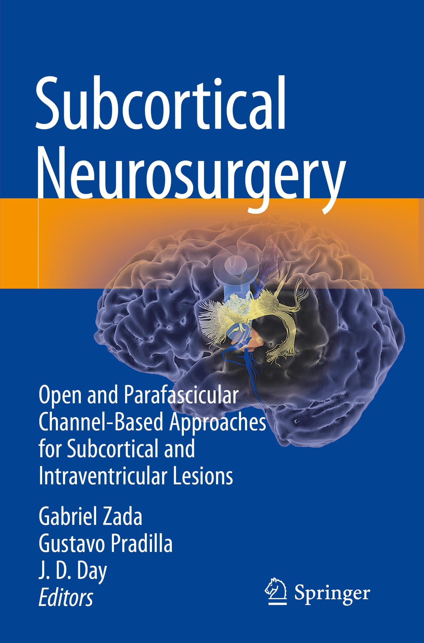 Cover: 9783030951559 | Subcortical Neurosurgery | Gabriel Zada (u. a.) | Taschenbuch | xii